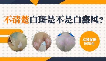 皮肤白斑不能吃酸水果吗